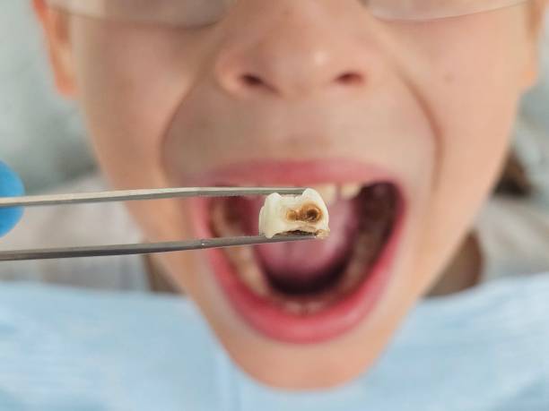 Best Orthodontic Emergency Dentist in Quincy, IL